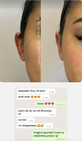Feedback